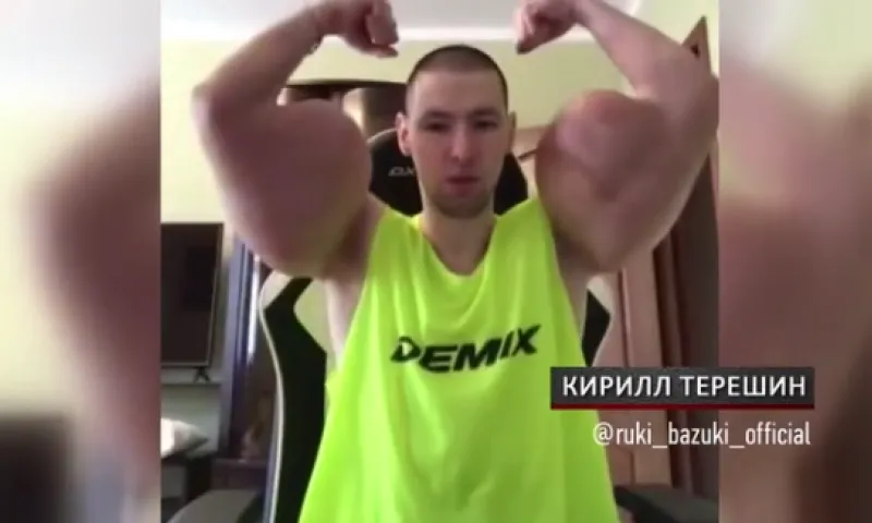 «Синтоловый качок» Кирилл Терешин признался, что готовится к операции на руках