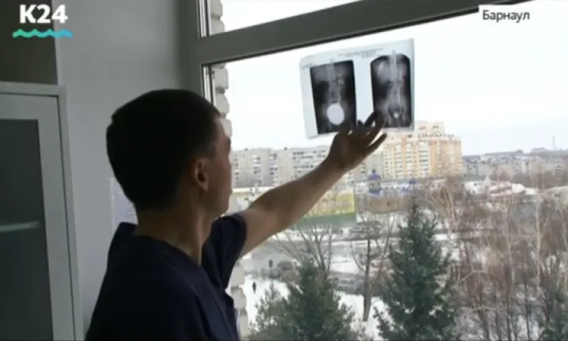 Уникальную операцию по пересадке мочеточника провели алтайские врачи 